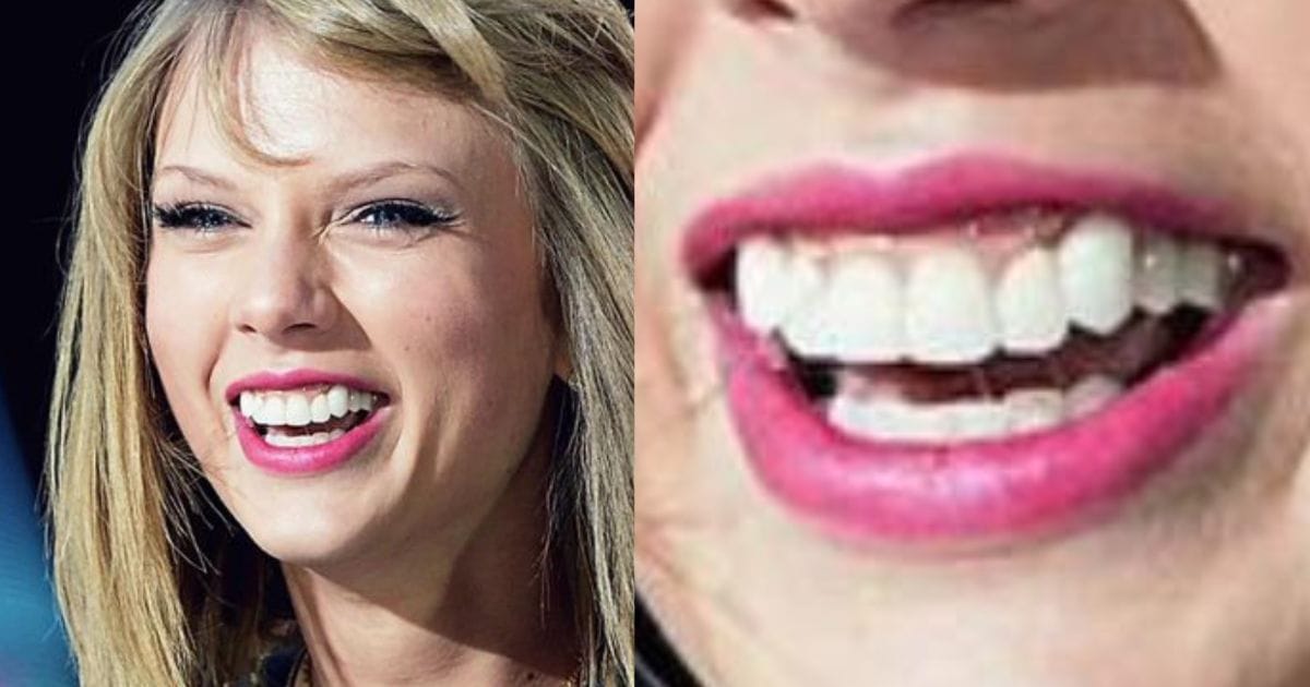 Taylor Swift canine detail